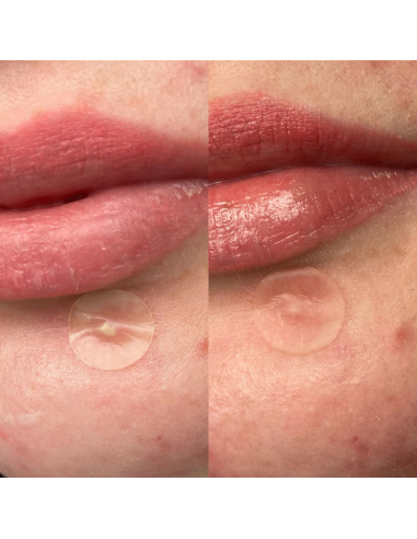 Dwuwarstwowe plastry na wypryski na dzień i na noc Hero Mighty Patch Duo 12 szt. 5010724000526 6