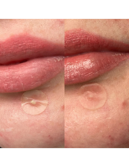 Dwuwarstwowe plastry na wypryski na dzień i na noc Hero Mighty Patch Duo 12 szt. 5010724000526 6